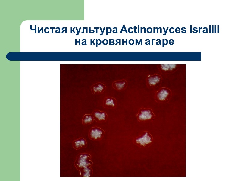 Чистая культура Actinomyces israilii на кровяном агаре